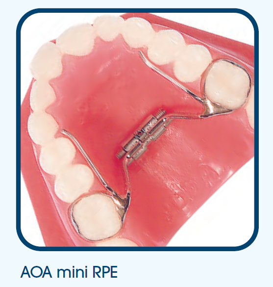 Palatal Expander Miriam V. Van Allen, DDS Los Angeles CA
